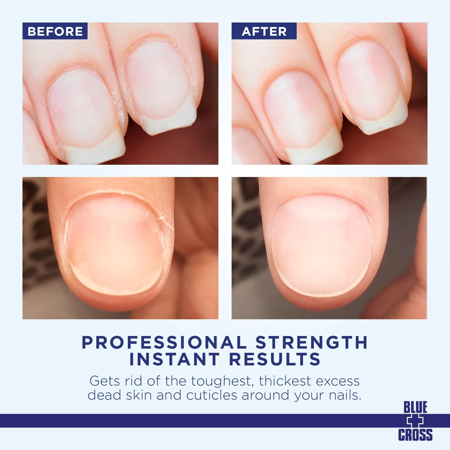 Before and after comparison of nails with text about professional strength instant results.