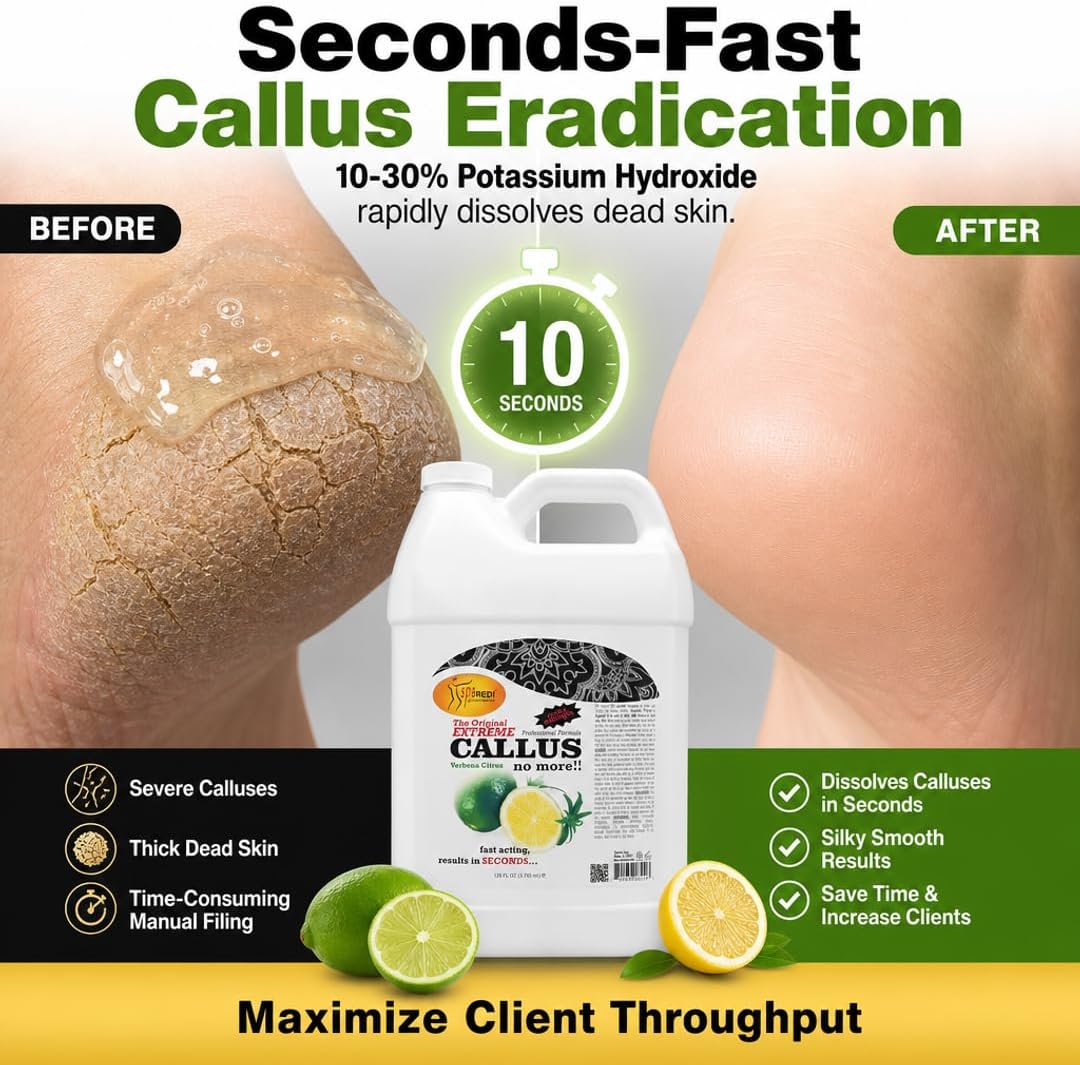 SPA Redi Lime & Lemon Callus Remover, 1 Gallon Before After